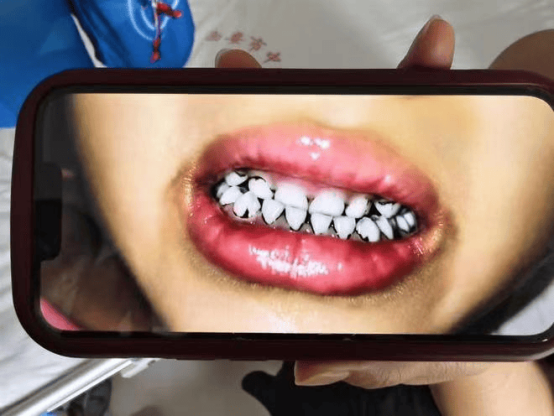 62159e7871e8a85a749890f6b2bc1b46.jpg 62159e7871e8a85a749890f6b2bc1b46.jpg